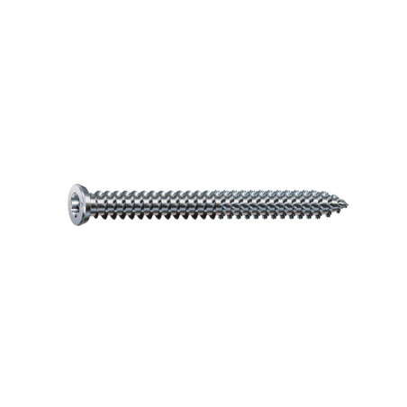 Vis d'ancrage chassis fenêtre Torx 7.5X112Mm Vrac Pochon 1Kg | Sanifer